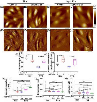 Vascular Endothelial Growth Factor Receptor-1 Modulates Hypoxia-Mediated Endothelial Senescence and Cellular Membrane Stiffness via YAP-1 Pathways